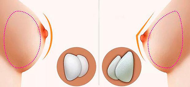 Размер груди: как определить? Таблица 1, 2, 3, 4, 5 и 6 размеры грудины у женщин